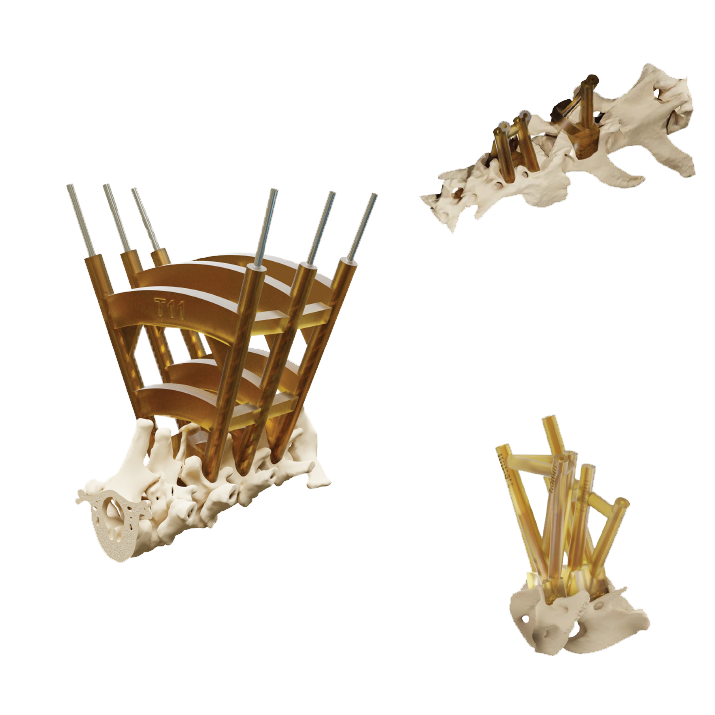 Spine