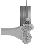 Custom Surgical Guides